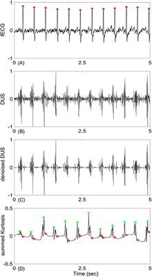 A Hybrid EMD-Kurtosis Method for Estimating Fetal Heart Rate from Continuous Doppler Signals